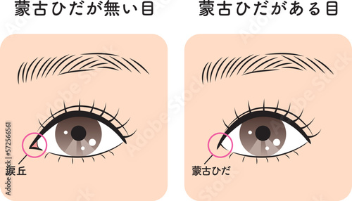 蒙古ひだがある目と無い目