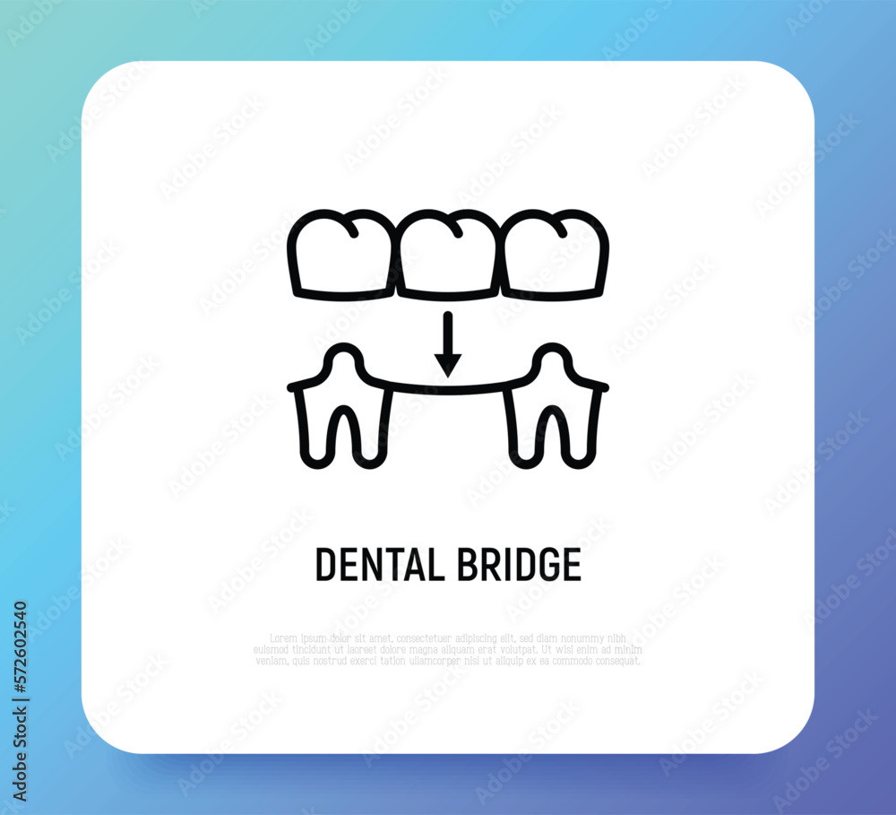 Dental bridge thin line icon. Dentistry, prosthesis. Tooth restoration. Vector illustration. Dental bridge thin line icon. Dentistry, prosthesis. Tooth restoration. Vector illustration.