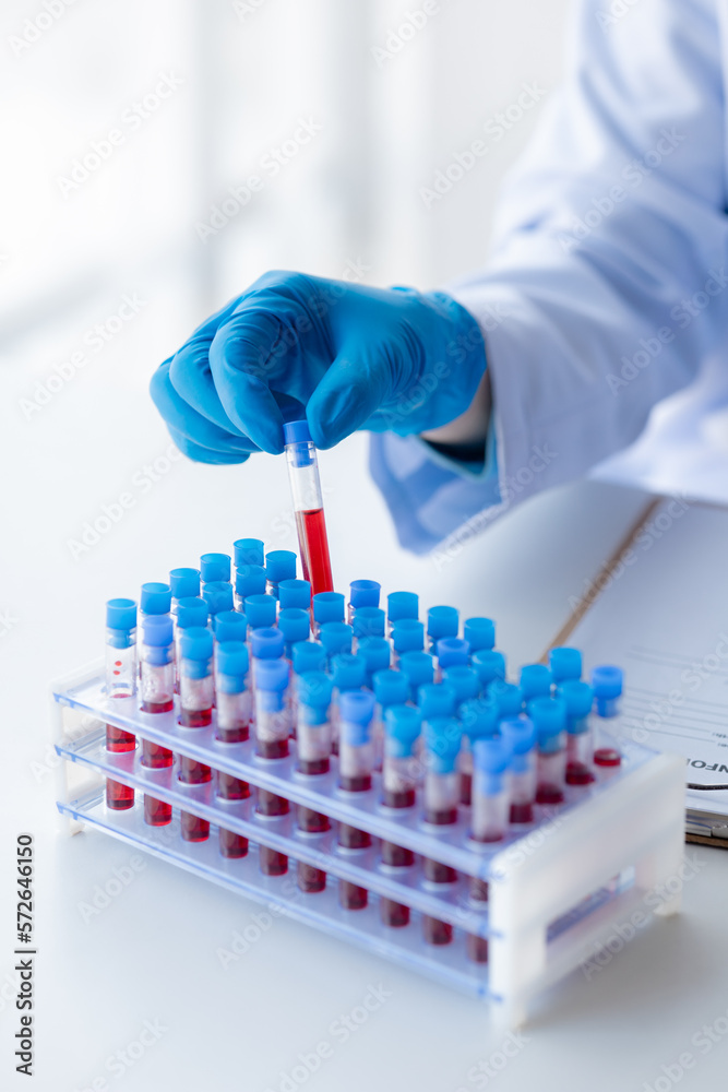 Lab assistant, a medical scientist, a chemistry researcher holds a glass tube through the blood sample, does a chemical experiment and examines a patient's blood sample. Medicine and research concept. Lab assistant, a medical scientist, a chemistry researcher holds a glass tube through the blood sample, does a chemical experiment and examines a patient's blood sample. Medicine and research concept.