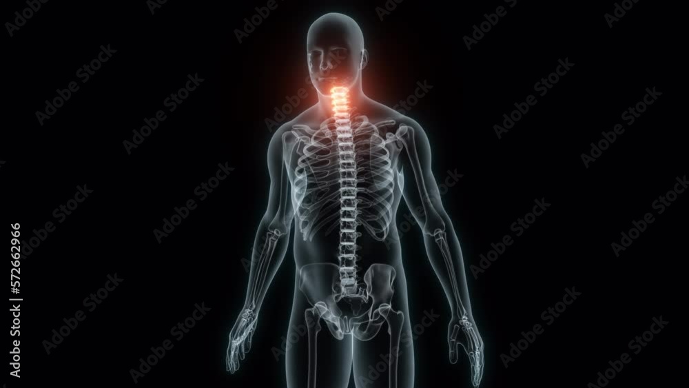 3D Rendering of a Medical Animation of the Cervical Vertebrae. X-ray of the Cervical Vertebrae. 3D Rendering of a Medical Animation of the Cervical Vertebrae. X-ray of the Cervical Vertebrae.