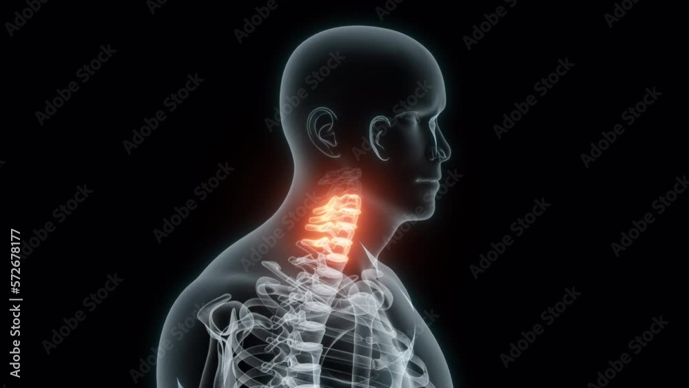 Cervical Check Animation 3D Rendering of a Medical Animation of the Cervical Vertebrae. X-ray of ...