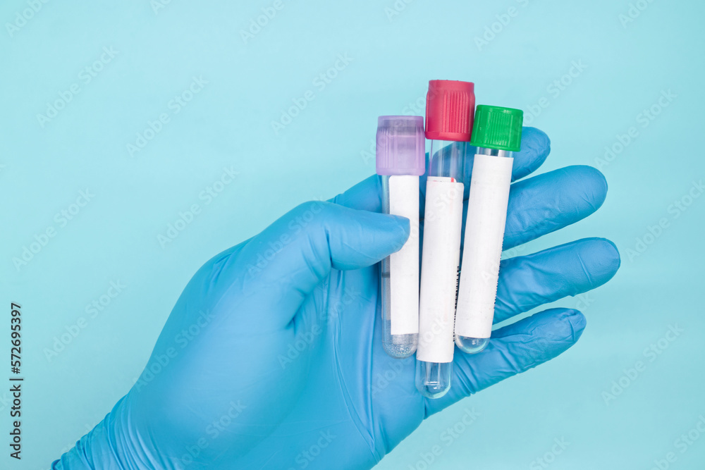 hand in medical glove holding three vacuum tubes for collection blood samples on blue background hand in medical glove holding three vacuum tubes for collection blood samples on blue background