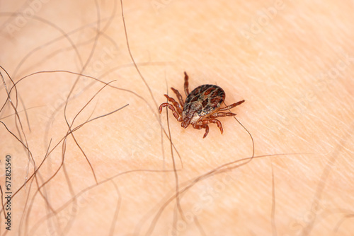 dangerous blood-sucking insect. small brown spotted mite, biological name Dermacentor reticulatus on human skin
