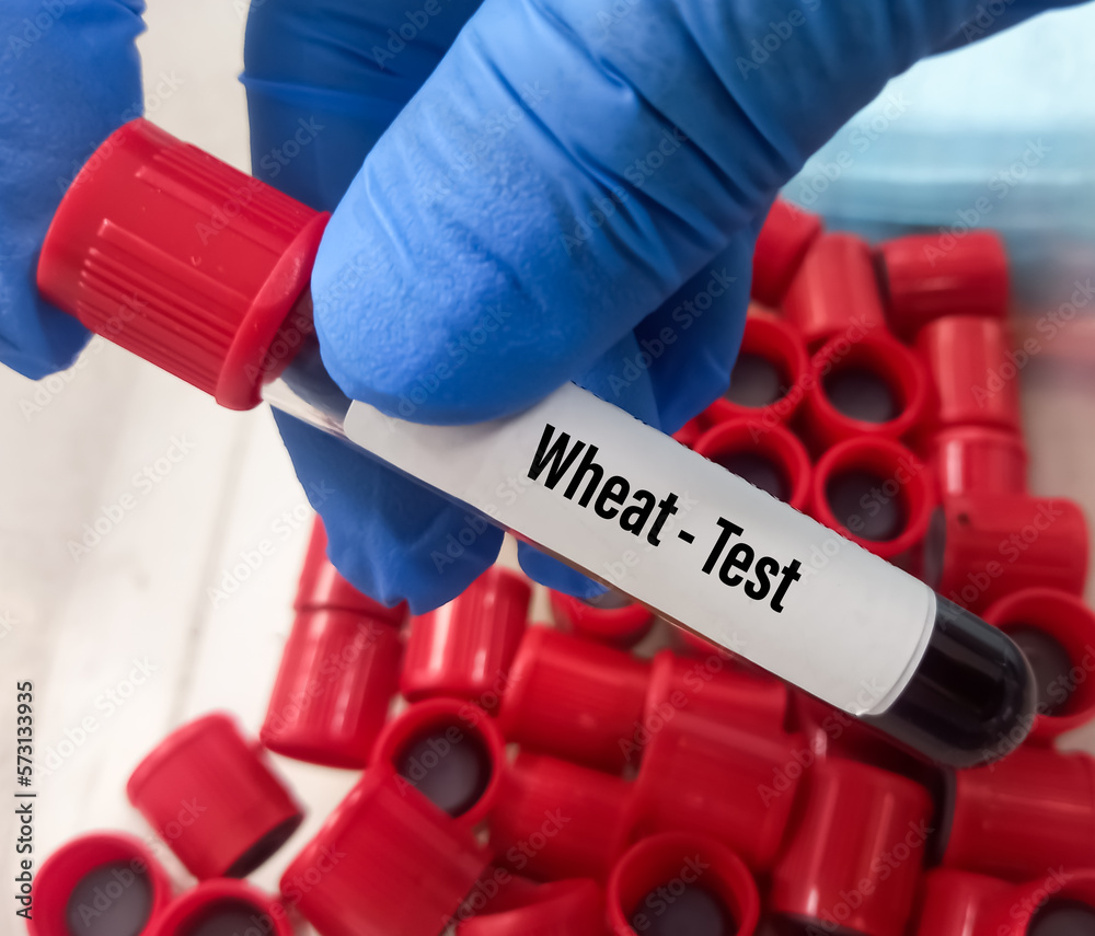 Blood Sample For Wheat Allergy Blood Test Test Tube In Doctor Hands Allergy Profile Test Blood Sample For Wheat Allergy Blood Test Test Tube In Doctor Hands Allergy Profile Test