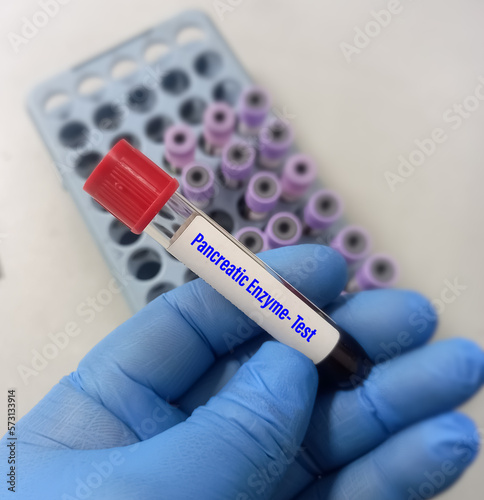 Blood sample for Pancreatic enzyme test, to diagnosis of pancreatitis. Amylase and lipase test. photo