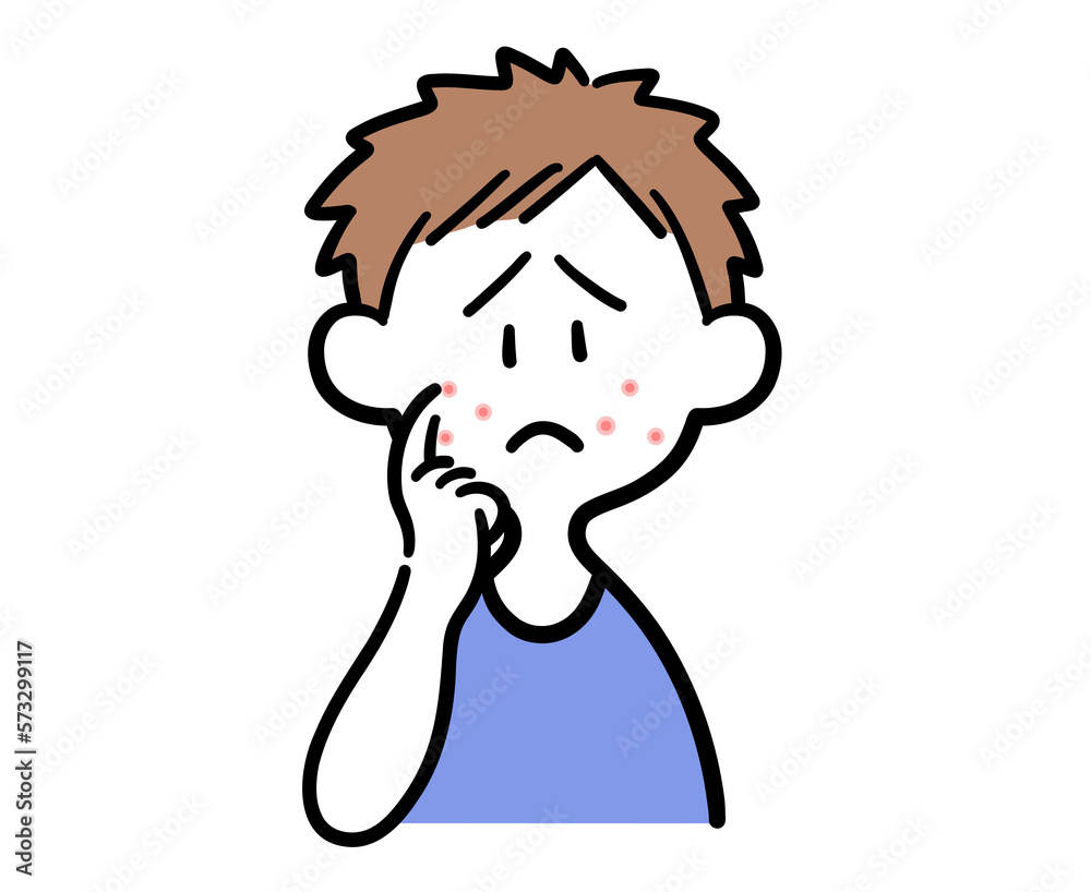 ニキビを気にする男性 ニキビを気にする男性