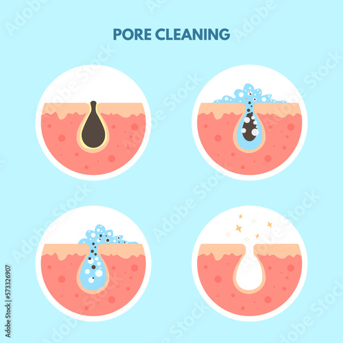 Removal skin blackheads. Acne oily skin cleansing process, used pimple foam remover or exfoliant, deep clean facial and body pore to spot blackhead sebum makeup vector illustration photo