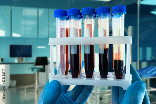 Test tubes with blood in ha...