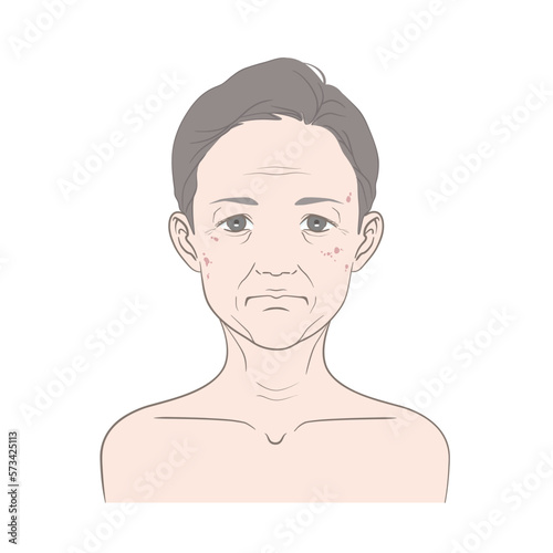 40代から60代くらいの中年女性のシミ、シワが気になる正面からの顔（主線あり・線画）