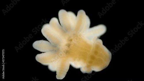 Young juvenile Actiniaria under a microscope, class Anthozoa, Hexacorallia, about 3-4 mm in size. The specimen was found in Barents Sea. Sea Hydra photo