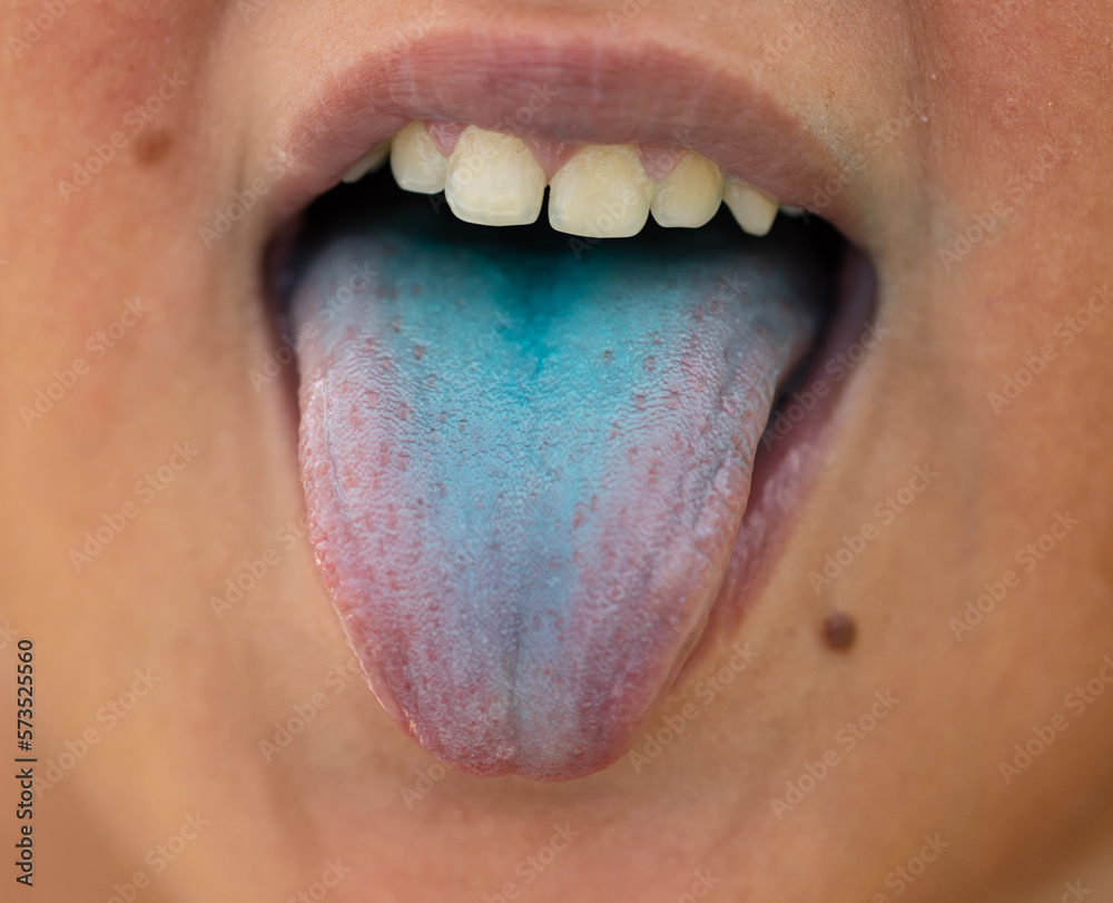 Obraz premium blue tongue in a child from dyes