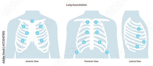 Lung auscultation. Thorax anterior, posterior, lateral position photo