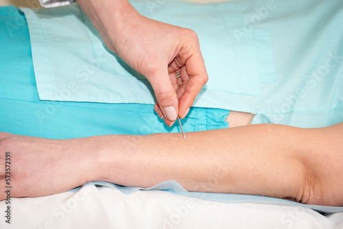Εκτύπωση καμβά Doctor neurologist checking reflexes of female patient with needle in clinic