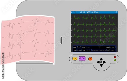 EKG illustration with a EKG paper in pink 