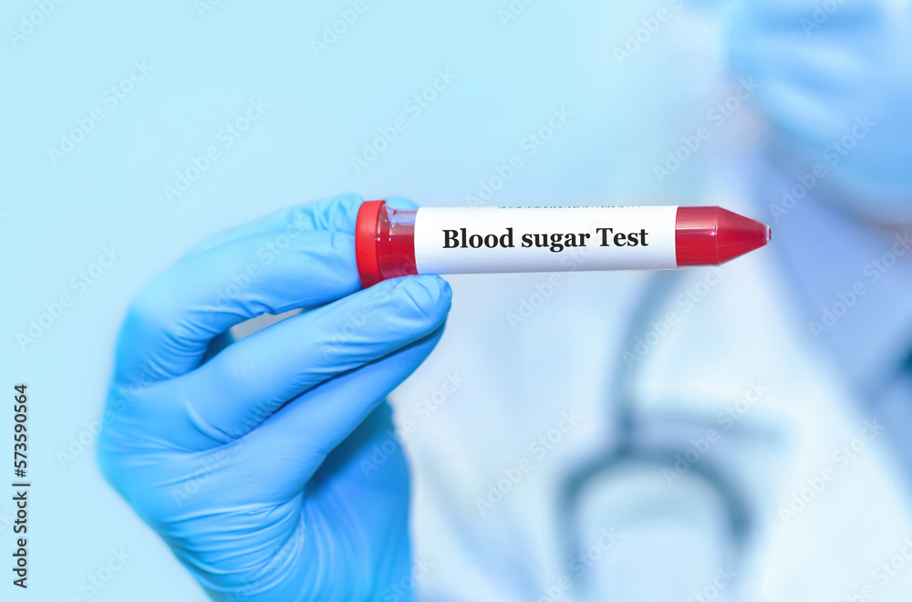 Doctor holding a test blood sample tube with Sugar test. Doctor holding a test blood sample tube with Sugar test.