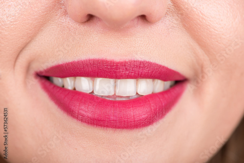 Woman Face With Pretty Smile and White Teeth. Studio Photo Shoot. Use Bright Red Lipstick.