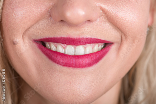 Happy Woman Face With Pretty Smile and White Teeth. Studio Photo Shoot. Use Bright Red Lipstick.