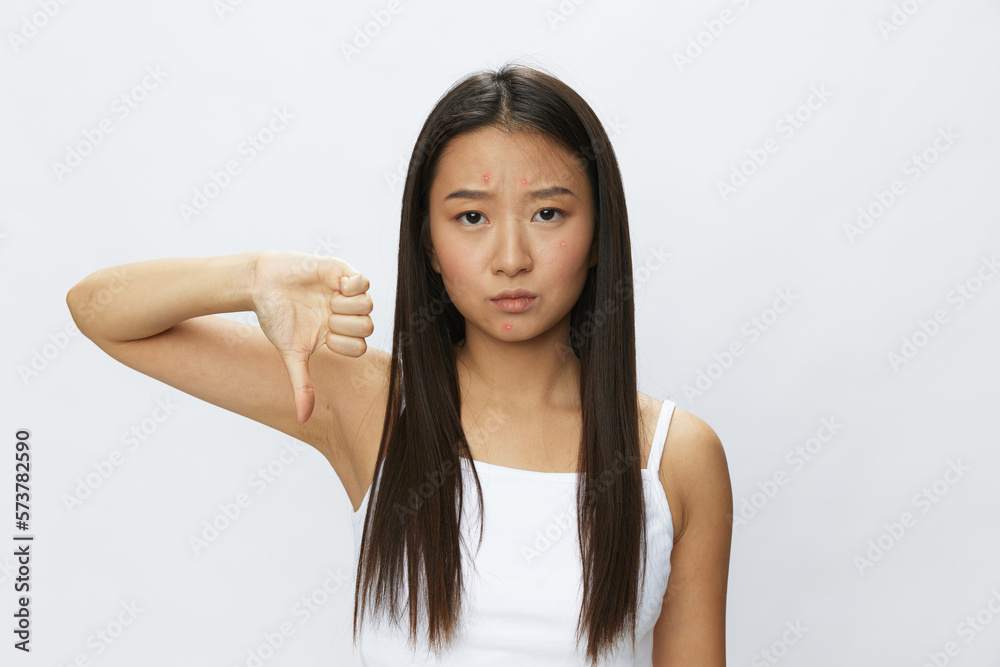 Asian woman facial skin problems, acne and inflammation, red rashes and allergies, chicken pox, sadness from rashes. Facial skin care concept for diseases and nerves Asian woman facial skin problems, acne and inflammation, red rashes and allergies, chicken pox, sadness from rashes. Facial skin care concept for diseases and nerves