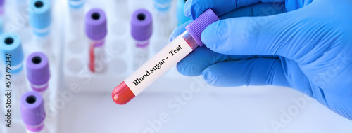 Doctor holding a test blood sample tube with Sugar test on the background of medical test tubes with analyzes.Copy space for text photo