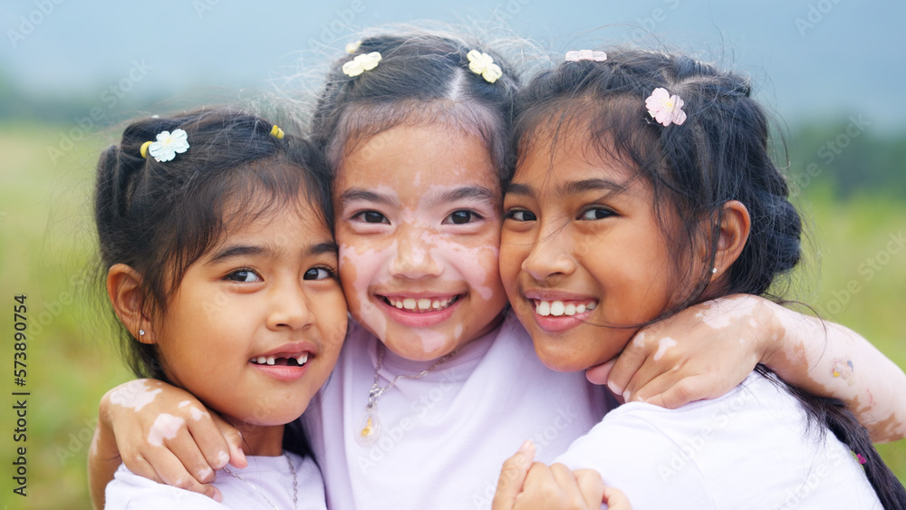 Little cute alpha young albino vitiligo small girl group smile look at camera fun joy hug in meadow field. Melanin face body of asia people gen z kid self love happy diverse of beauty skin care color. Little cute alpha young albino vitiligo small girl group smile look at camera fun joy hug in meadow field. Melanin face body of asia people gen z kid self love happy diverse of beauty skin care color.
