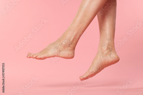 Closeup view of woman with varicose veins on pink background