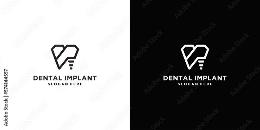 Dentistry clinic logo design with dental implant logo abstract geometric lines creative design