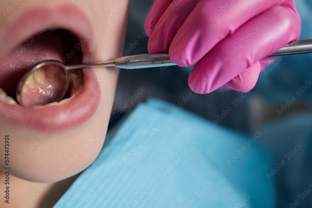 A closeup of a young girl getting a dental exam by dentist and using
