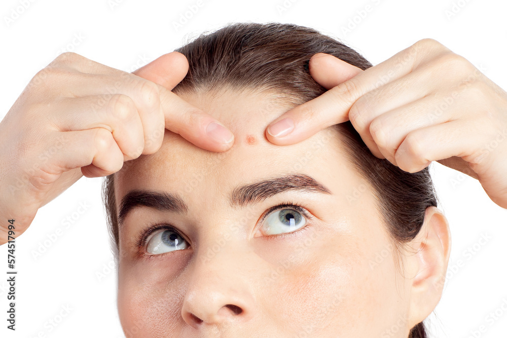 Woman has a problematic skin. She squeezing pimple on her face. Close-up photo on a white background