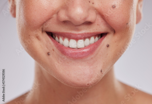 Closeup, teeth and woman with dental care, cosmetics and treatment against grey studio background. Zoom, female and lady with whitening, mouth and oral care with smile, morning routine and grooming