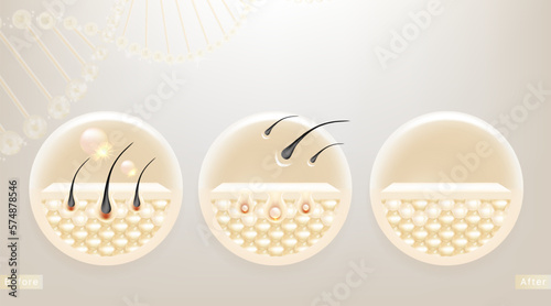 Hyaluronic acid before and after hair and skin solutions ad, white removing serum drop over skin cells with cosmetic advertising background ready to use, illustration vector.	