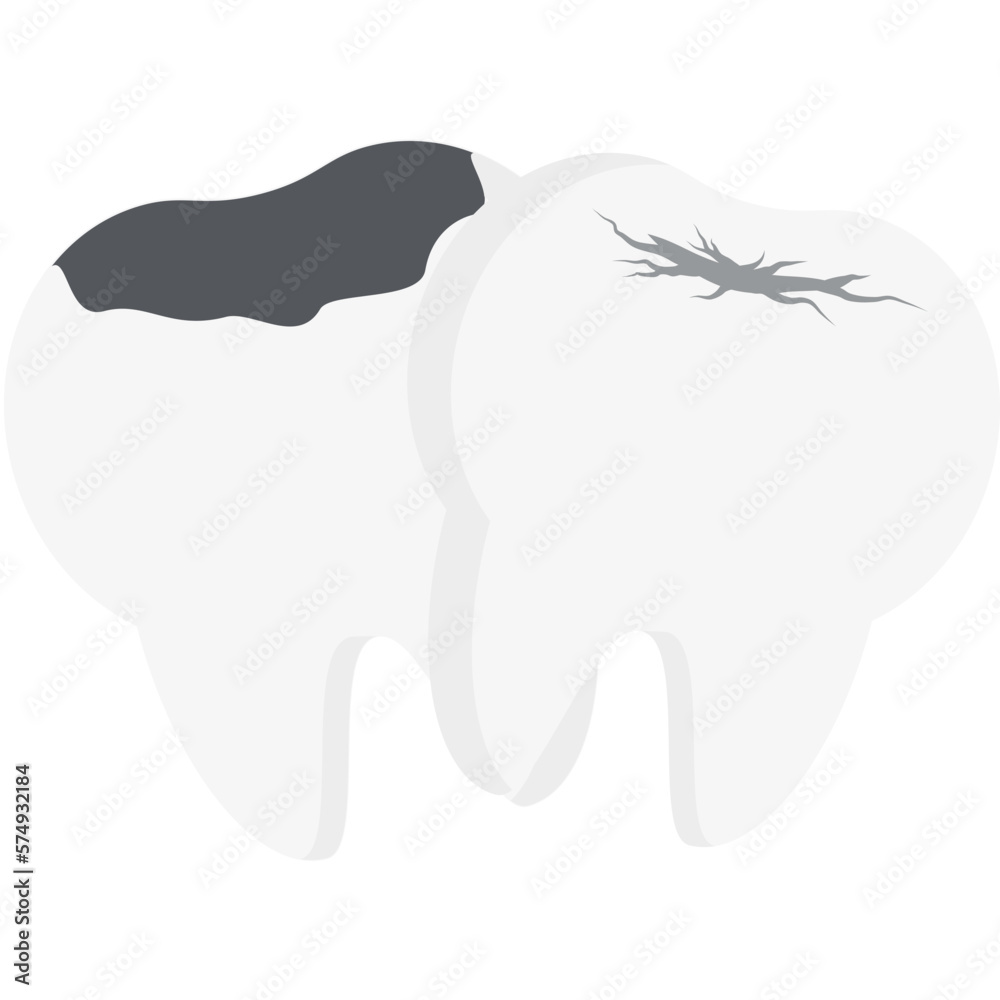 Double Tooth Broken Cavity Cracked Teeth
Double Tooth Broken Cavity Cracked Teeth