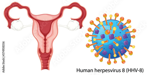 Vaginal infection bacteria concept