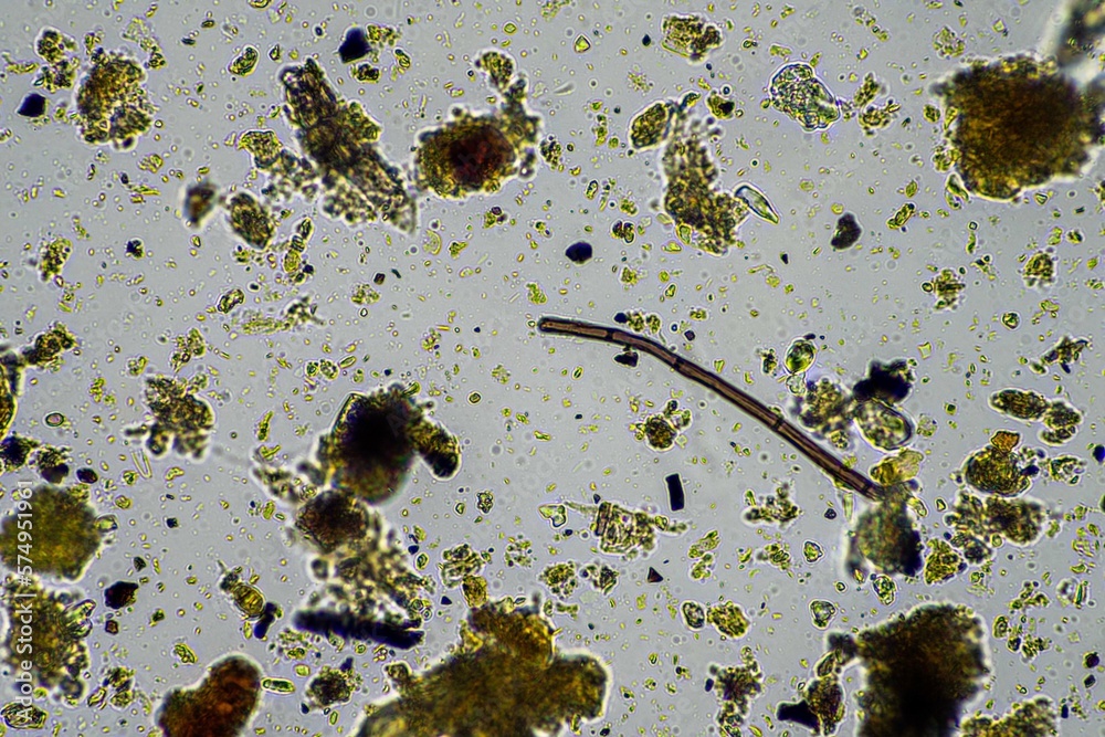 Soil Microorganisms In A Soil Sample, Soil Fungus And Bacteria On A ...