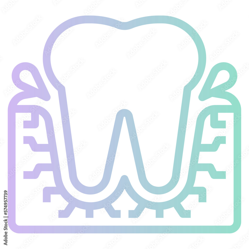 gingivitis gingivitis