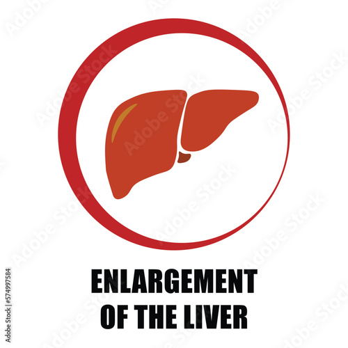 Enlargement of the liver, symptom symbol in red circle