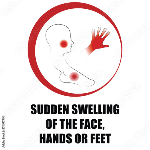 Sudden swelling of the face, hands or feet, symptom symbol in red circle