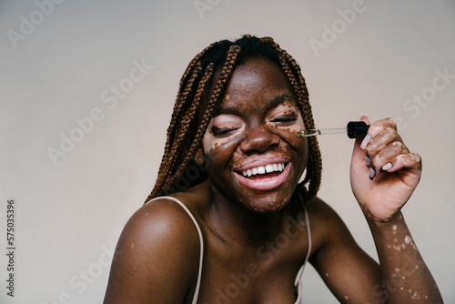 portrait of a pretty african woman with vitiligo applying an essence serum with a dropper while smiling