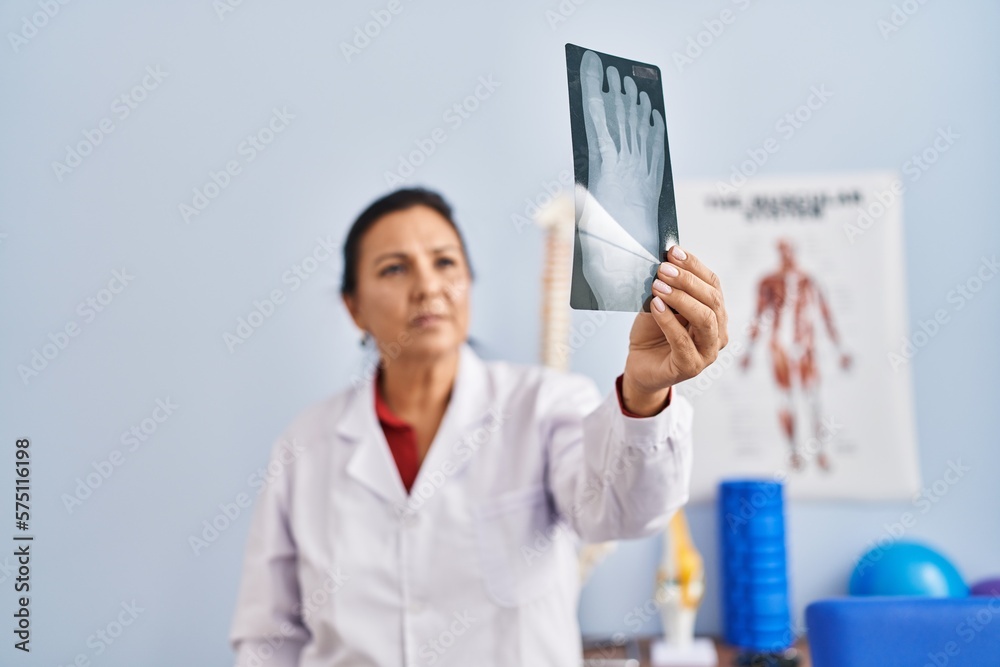 Middle age hispanic woman physiotherapist holding radiography at rehab clinic Middle age hispanic woman physiotherapist holding radiography at rehab clinic