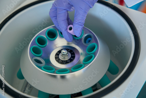 Hematologist removes a test tube with biomaterial from hematological centrifuge