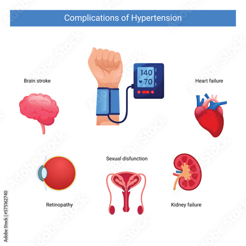 Hypertension complications infographics