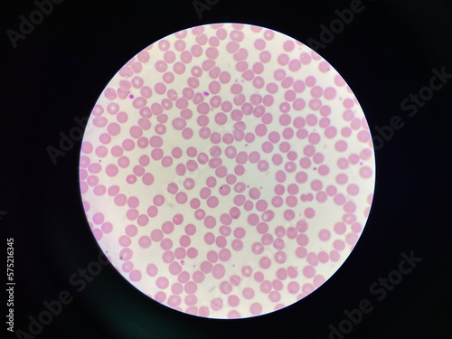 Normalchromic normocytic red blood cell. photo
