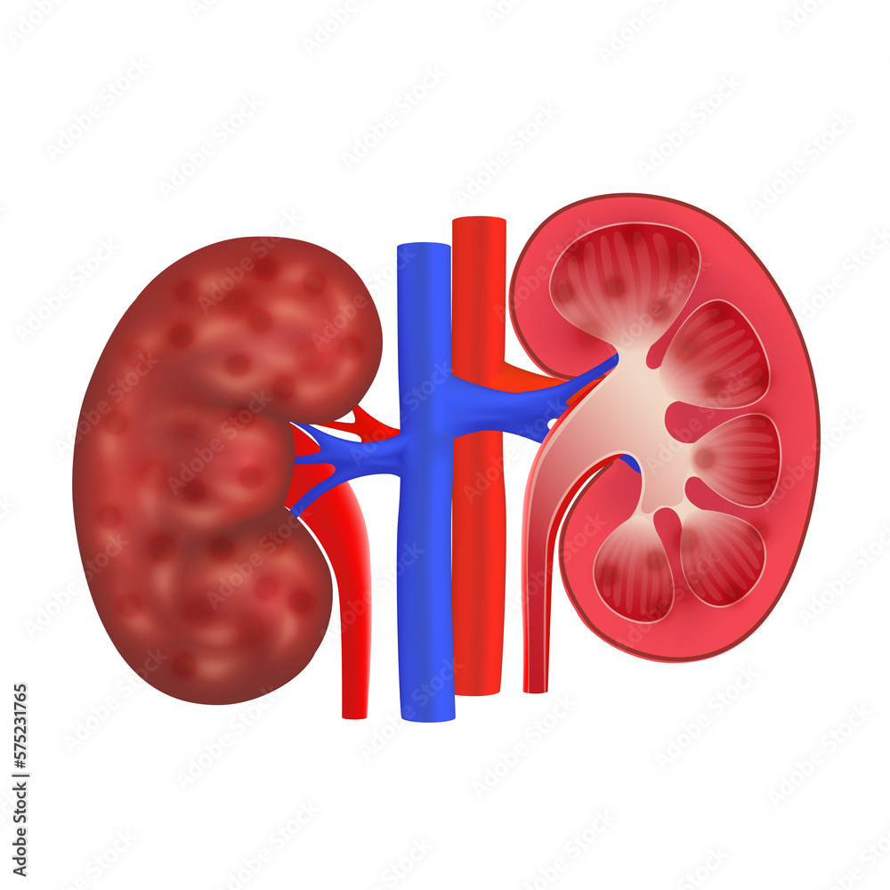 Chronic kidney disease, Human kidneys red model. Medical pharmaceutical