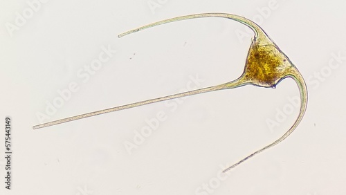 Ceratium sp, a marine phytoplankton from dinoflagellata group. Lugol preserved sample. 400x magnification photo