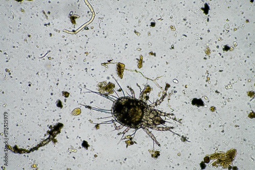 soil parasite in a sample under the microscope on a farm in Australia 