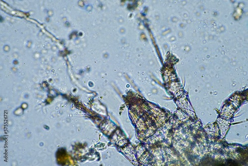 soil parasite in a sample under the microscope on a farm in Australia 