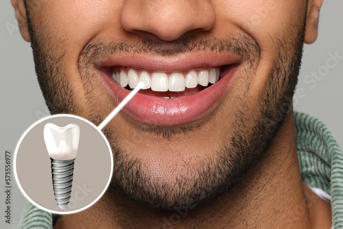 Foto Happy man with perfect teeth smiling on grey background, closeup