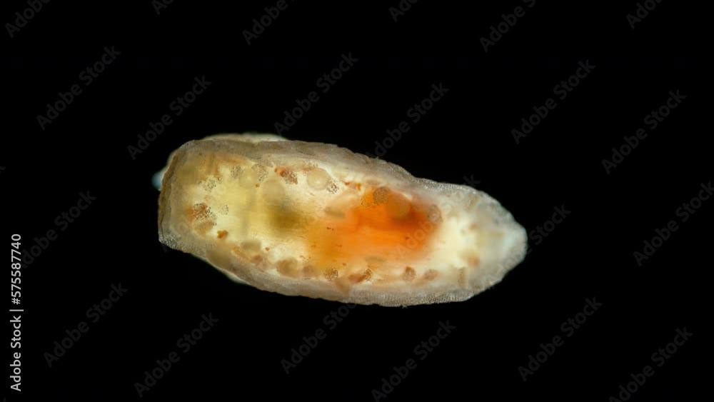 Pentacula Holothuroidea larva, Juvenile sea cucumber under microscope