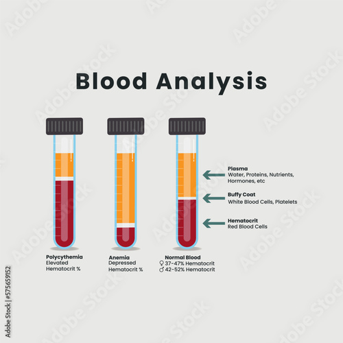 Blood Analysis in test tubes vector