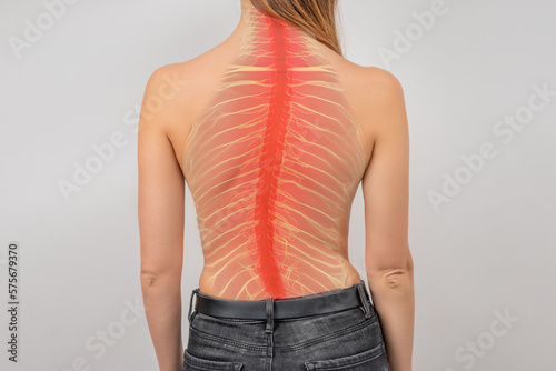 Woman with scoliosis of the spine. Curved woman's back. Terrible pain in the spine photo