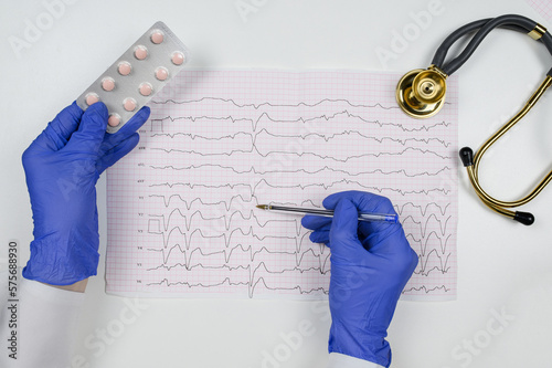 Fotografi A doctor in blue gloves holds an ECG in his hands with rhythm disturbance and extrasystole, points with a pen to pathology and holds pills for treatment, a stethoscope lies on the table next to him
